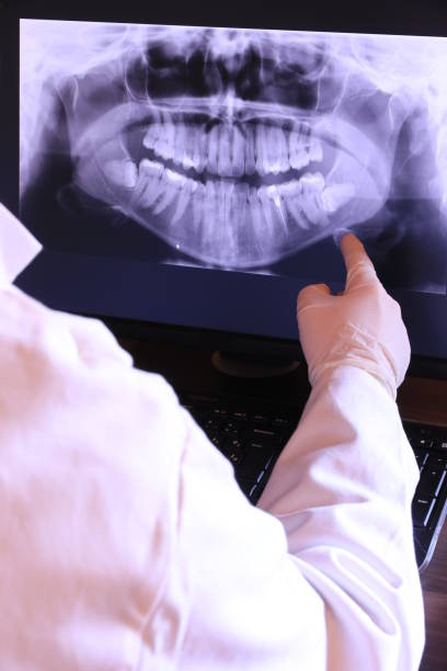 Best Emergency Root Canal Treatment in Princeton, MN
